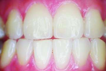 Quite Interesting Things about … teeth - John Lloyd